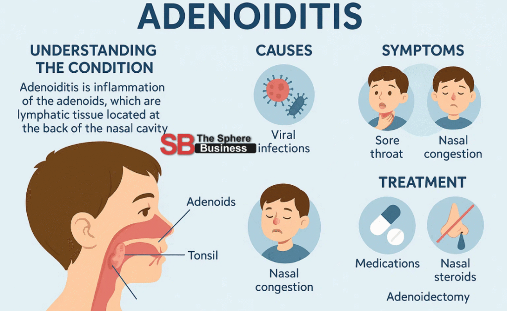 Adenoidid: Understanding the Condition, Causes, Symptoms, and Treatment Adenoidid